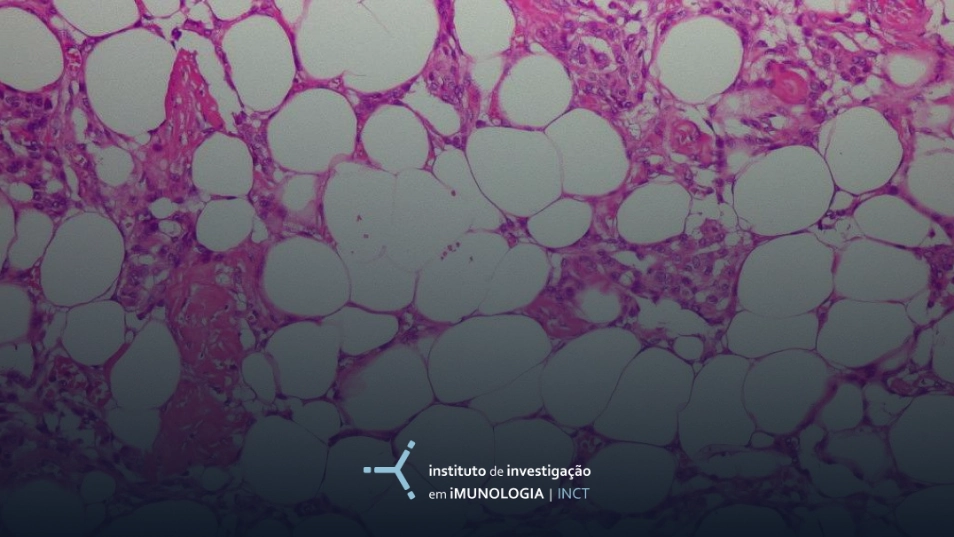 Como não “inflamar” o tecido adiposo na obesidade