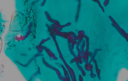 Doenças Infecciosas