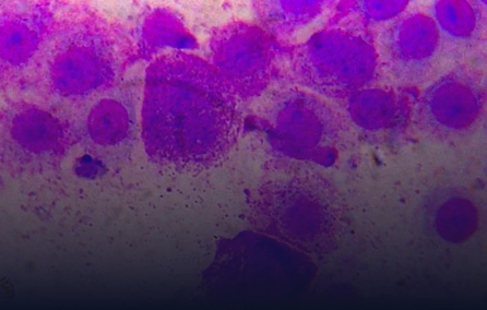 Fisiopatologia da cura espontânea da mastocitose cutânea