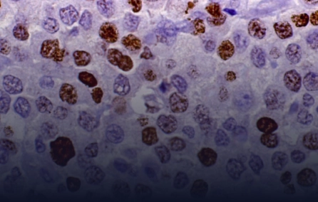 Interação dos mastócitos e melanócitos na manifestação cutânea da mastocitose