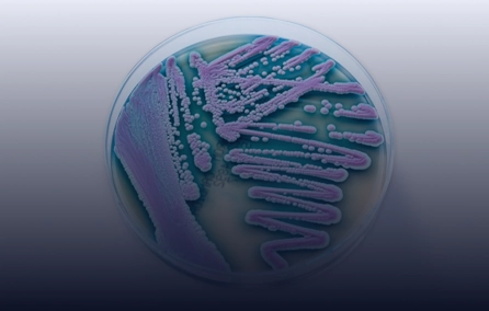 Relevância e implicações fisiopatológicas da sensibilização fúngica na asma e seus sub-endótipos